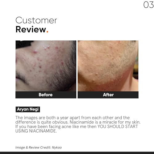 Minimalist Niacinamide 10% + Vitamin C 10% Face Serum Combo | Acne Marks, Dark Spots, Oil Control & Skin Brightening | Pore Minimizing & Glow Boosting Skincare | Oily, Combination & Acne Prone Skin